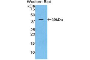 Western blot analysis of the recombinant protein. (C3 antibody  (AA 966-1313))