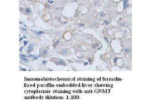 Image no. 1 for anti-Glycine N-Methyltransferase (GNMT) antibody (ABIN6583849)