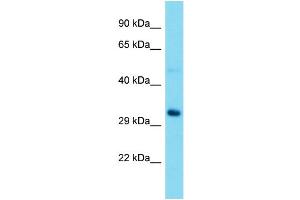 Western Blotting (WB) image for anti-Ribosomal RNA Processing 15 Homolog (RRP15) (Middle Region) antibody (ABIN2774509) (RRP15 antibody  (Middle Region))