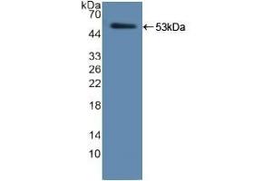 Detection of Recombinant ELA2, Human using Polyclonal Antibody to Neutrophil Elastase (NE) (ELANE antibody  (AA 30-247))