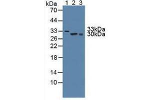Western blot analysis of (1) Human Serum, (2) Human Lung Tissue and (3) Human A549 Cells. (FKBP7 antibody  (AA 24-217))
