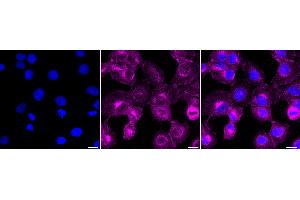 anti-Neuropilin 1 (NRP1) antibody