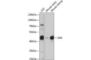 Western blot analysis of extracts of various cell lines, using ADK antibody (ABIN7265463) at 1:1000 dilution. (ADK antibody  (AA 200-345))