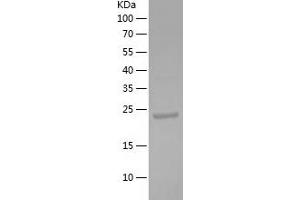 Western Blotting (WB) image for Keratin 1 (KRT1) (AA 487-644) protein (His-IF2DI Tag) (ABIN7123670) (Cytokeratin 1 Protein (AA 487-644) (His-IF2DI Tag))
