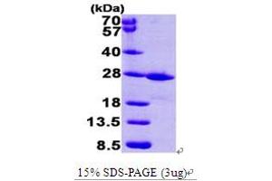 SDS-PAGE (SDS) image for FK506 Binding Protein 14, 22 KDa (FKBP14) (AA 20-211) protein (His tag) (ABIN667027)