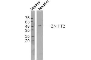 ZNHIT2 antibody  (AA 51-150)