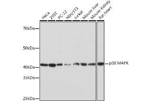 Western blot analysis of extracts of various cell lines, using p38 MAPK Rabbit mAb (ABIN1682699, ABIN3019202, ABIN3019203 and ABIN7101731) at 1:1000 dilution.