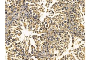 pan Actin Mouse Monoclonal Antibody at 1/100 staining mouse testis tissue by IHC-P.