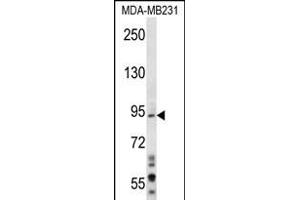 D1L1 Antibody (N-term) (ABIN656281 and ABIN2845591) western blot analysis in MDA-M cell line lysates (35 μg/lane). (MAD1L1 antibody  (N-Term))
