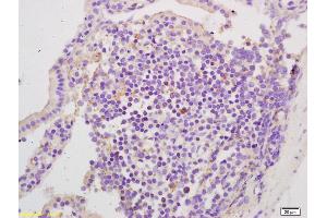 Formalin-fixed and paraffin embedded mouse intestine labeled with Rabbit Anti EphA2/Eph receptor A2 Polyclonal Antibody, Unconjugated (ABIN669201) at 1:200 followed by conjugation to the secondary antibody and DAB staining (EPH Receptor A2 antibody  (AA 901-976))