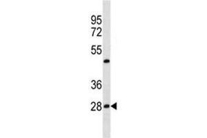 Prohibitin antibody western blot analysis in HepG2 lysate.