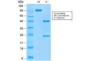 SDS-PAGE analysis of purified, BSA-free recombinant TRAcP antibody (clone rACP5/1070) as confirmation of integrity and purity. (ACP5 antibody)