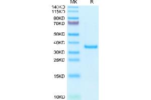 SFRP2 Protein (AA 25-295) (His tag)