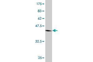 Western Blot detection against Immunogen (45. (NUDT4 antibody  (AA 1-181))