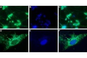 Expression of neuropeptide Y4 receptor in rat DRG - Immunocytochemical staining of a primary culture of rat dorsal root ganglion (DRG) neurons. (NPY4R antibody  (Intracellular))