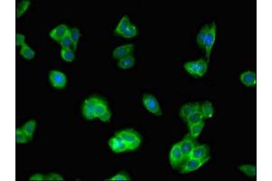 Immunofluorescent analysis of HepG2 cells using ABIN7157038 at dilution of 1:100 and Alexa Fluor 488-congugated AffiniPure Goat Anti-Rabbit IgG(H+L) (IQCG antibody  (AA 1-134))