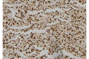 ABIN6276450 at 1/100 staining Human lung tissue by IHC-P. (NCK1 antibody  (Internal Region))