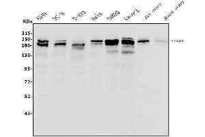 Western blot analysis of Integrin beta 4/ITGB4 using anti-Integrin beta 4/ITGB4 antibody (ABIN7601135).