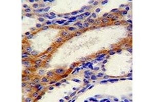 STIM1 antibody immunohistochemistry analysis in formalin fixed and paraffin embedded human kidney tissue. (STIM1 antibody  (AA 509-538))