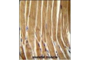 CASP5 Antibody (Center) (ABIN654898 and ABIN2844547) immunohistochemistry analysis in formalin fixed and paraffin embedded human skeletal muscle followed by peroxidase conjugation of the secondary antibody and DAB staining. (CASP5 antibody  (AA 162-191))