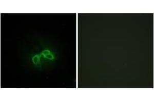 Immunofluorescence analysis of NIH-3T3 cells, using BLCAP Antibody. (BLCAP antibody  (AA 38-87))