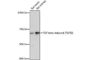 Western blot analysis of extracts of various cell lines, using TGF beta induced TGF beta induced (TGFBI) Rabbit mAb (ABIN7270915) at 1:1000 dilution. (TGFBI antibody)
