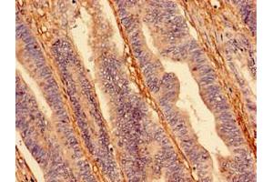 Immunocytochemistry (ICC) image for anti-Hypoxia Inducible Factor 1, alpha Subunit (Basic Helix-Loop-Helix Transcription Factor) (HIF1A) (AA 579-826) antibody (ABIN7156029)