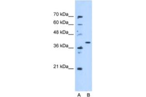 Western Blotting (WB) image for anti-Enoyl CoA Hydratase Domain Containing 3 (ECHDC3) antibody (ABIN2463233)