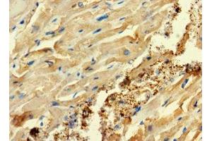 Immunohistochemistry of paraffin-embedded human heart tissue using ABIN7152994 at dilution of 1:100 (C2ORF83 antibody  (AA 29-150))