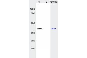 L1 rat kidney lysates L2 rat brain lysates probed with Anti CTHRC1 Polyclonal Antibody, Unconjugated  at 1:200 in 4˚C. (CTHRC1 antibody  (AA 31-130))
