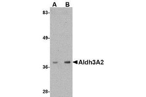 Image no. 1 for anti-Aldehyde Dehydrogenase 3 Family, Member A2 (ALDH3A2) (C-Term) antibody (ABIN342713) (ALDH3A2 antibody  (C-Term))