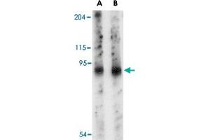 Western blot analysis of SLITRK6 in mouse lung tissue lysate with SLITRK6 polyclonal antibody  at (A) 0. (SLITRK6 antibody  (Internal Region))