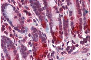 Human Small Intestine (formalin-fixed, paraffin-embedded) stained with NOD2 antibody ABIN351443 at 3 ug/ml followed by biotinylated goat anti-rabbit IgG secondary antibody ABIN481713, alkaline phosphatase-streptavidin and chromogen. (NOD2 antibody  (N-Term))