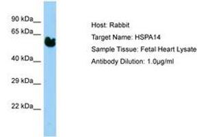 Image no. 1 for anti-Heat Shock 70kDa Protein 14 (HSPA14) (AA 37-86) antibody (ABIN6750192)
