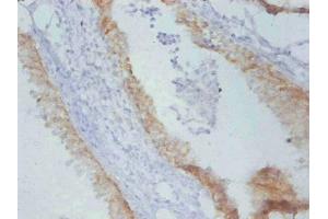 Immunohistochemistry of paraffin-embedded Rat prostate cancer using ABIN7179094 at dilution of 1:100.