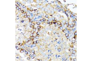 Immunohistochemistry of paraffin-embedded mouse testis using eIF2A Rabbit mAb (ABIN7267035) at dilution of 1:100 (40x lens). (EIF2A antibody)
