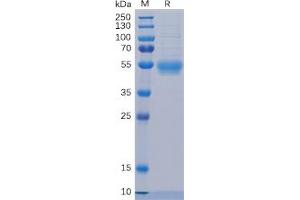Human IL5RA Protein, His Tag on SDS-PAGE under reducing condition. (IL5RA Protein (His tag))