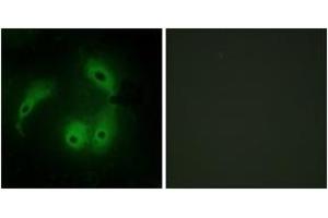 Immunofluorescence analysis of HeLa cells, using AKAP14 Antibody.