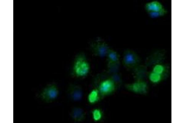 ZSCAN21 antibody