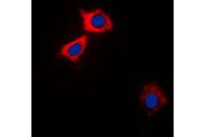 Immunofluorescent analysis of CaMK2 alpha/delta staining in HEK293A cells. (CaMK2 alpha/delta antibody  (Center))