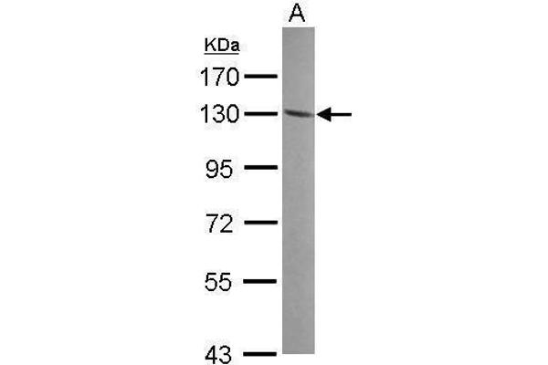 ENPP1 antibody