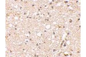 Immunohistochemical staining of human brain tissue using AP30381PU-N Grik1 antibody at 2. (GRIK1 antibody  (Center))
