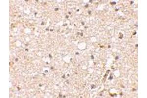 Immunohistochemical staining of human brain tissue using AP30381PU-N Grik1 antibody at 2.