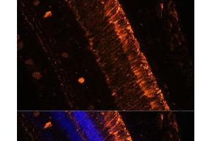 Immunofluorescence (IF) image for anti-Potassium Voltage-Gated Channel, Delayed-Rectifier, Subfamily S, Member 2 (KCNS2) antibody (ABIN7258586)