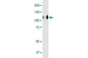 CEACAM1 MaxPab polyclonal antibody. (CEACAM1 antibody  (AA 1-464))