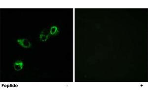 Immunofluorescence analysis of MCF-7 cells, using CCRL1 polyclonal antibody . (CCRL1 antibody  (C-Term))
