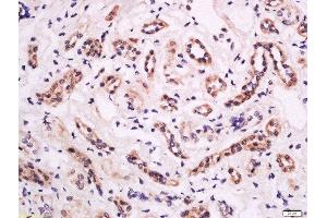 Formalin-fixed and paraffin embedded human kidney tissue labeled with Anti-CD18 (Thr758) Polyclonal Antibody, Unconjugated  at 1:200 followed by conjugation to the secondary antibody and DAB staining. (Integrin beta 2 antibody  (pThr758))