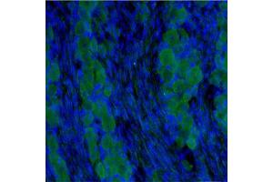 IF on rat DRG (postnatal day 7) at 40 µg/ml concentration using Sheep antibody to extracellular domain of TrkC (Trk-C, NTRK3, NT-3 growth factor receptor): IgG (ABIN351085), DAPI counterstained. (NTRK3 antibody  (Extracellular Domain))