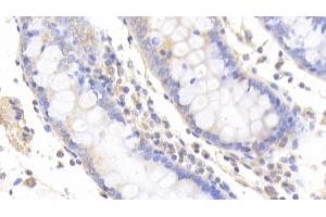 Detection of Slit2 in Human Colon Tissue using Polyclonal Antibody to Slit Homolog 2 (Slit2) (SLIT2 antibody  (AA 664-777))
