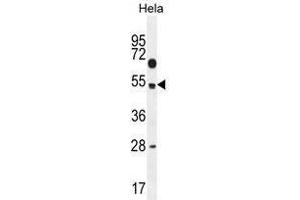 TSPYL6 Antibody (Center) western blot analysis in Hela cell line lysates (35 µg/lane). (TSPY-Like 6 antibody  (Middle Region))